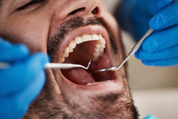 Best Pediatric Emergency Dentist in Christiansburg, VA